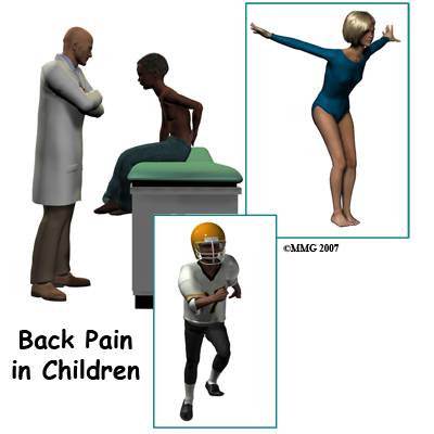 Back Pain in Children